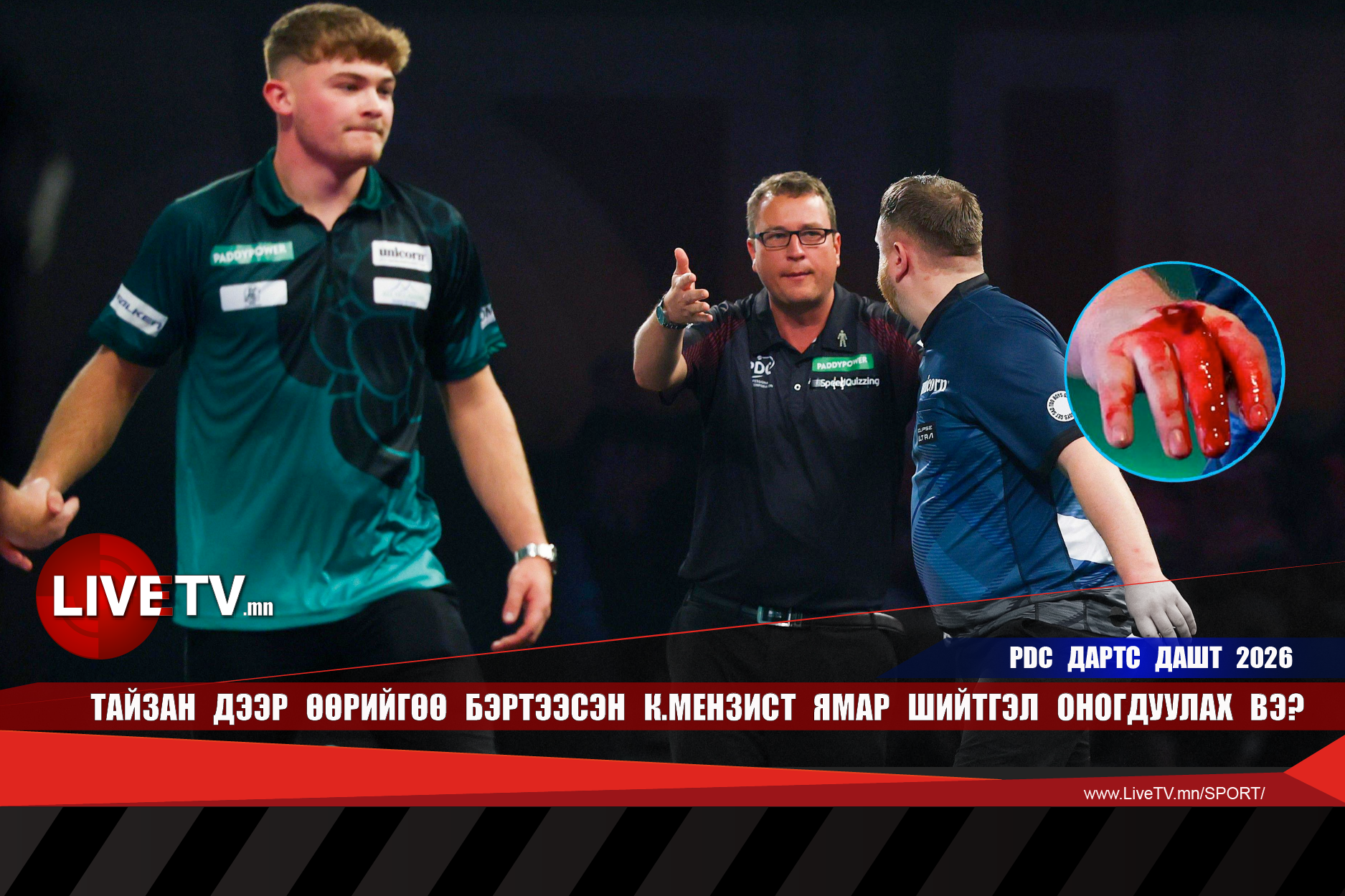 Тайзан дээр өөрийгөө бэртээсэн К.Мензист ямар шийтгэл оногдуулах вэ?