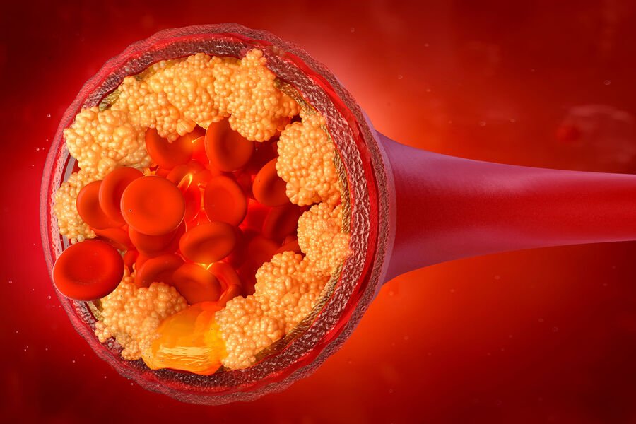 Шөнийн авто замын чимээ холестерины хэмжээг нэмэгдүүлдэг болохыг эрдэмтэд тогтоов